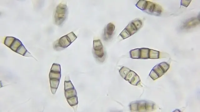 Living Organisms Are Starting to Consume Plastic Waste